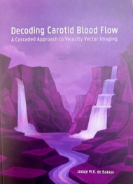Decoding carotid blood flow; a cascaded approach to velocity vector imaging