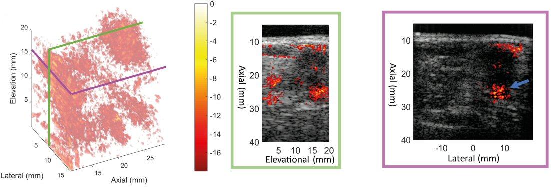 MUSIC 3D perfusion