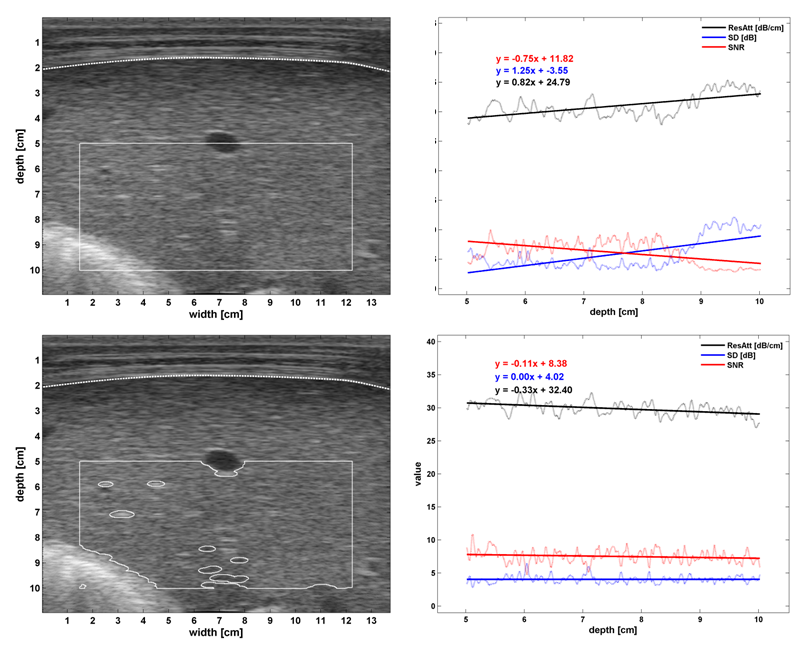 MUSIC caus segmentation